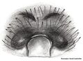 Epigyne
