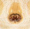 Epigyne