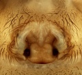 Epigyne