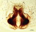 Epigyne