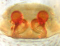 Vulva