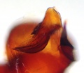 Embolus