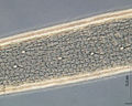 Haare und Chitinformationen des Beines von Nemastoma lugubre.