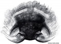 Epigyne