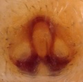 Epigyne