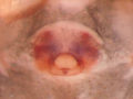 Epigyne