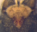 Epigyne