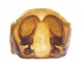 Vulva