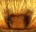 Epigyne