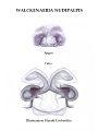 Zeichnung Epigyne und Vulva