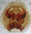 Epigyne